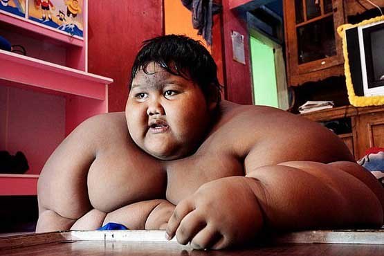 چاق‌ترین کودک جهان، قبل و بعد از کاهش وزن (+تصاویر)
