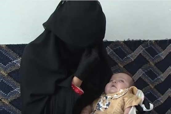 یک نوزاد؛ قربانی جدید محاصره فرودگاه صنعا +عکس