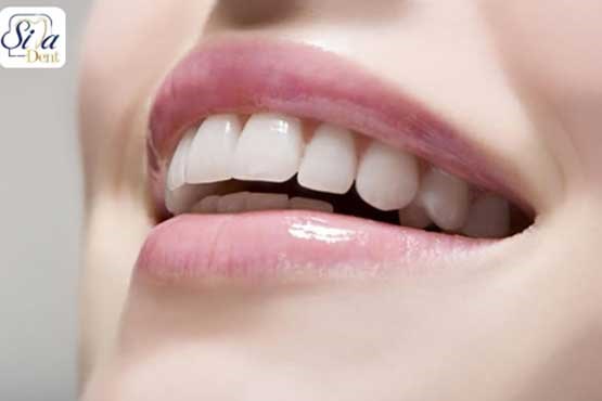دندانپزشکی زیبایی شامل چه مواردی است؟