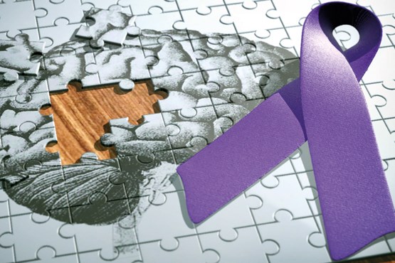 عامل اصلی آلزایمر چیست؟