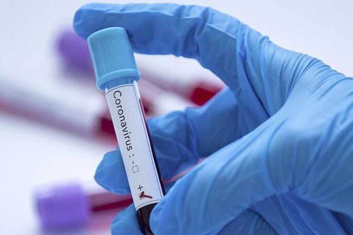 مطالعات محققان ویروس‌شناس دانشگاه آلبرتا نشان می‌دهد یک داروی ضد ویروسی که در سال ۲۰۱۴ میلادی برای درمان ابولا ساخته شد، در توقف مکانیسم تکثیر ویروس جدید کرونا موثر است.