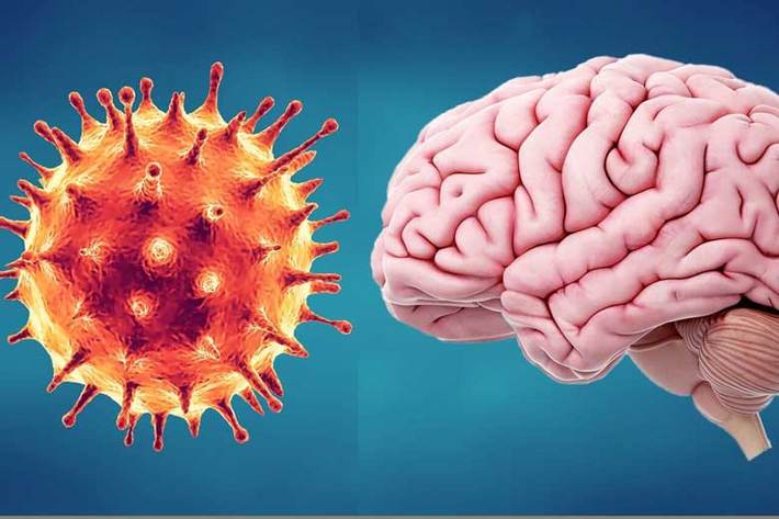 محققان دانشگاه ام آی تی آمریکا با بررسی نحوه تقابل بیماری کرونا با سیستم ایمنی بدن به مطالعه آثار پایدار این عفونت ویروسی بر سلامت سیستم عصبی مرکزی انسان و به ویژه مغز پرداختند.