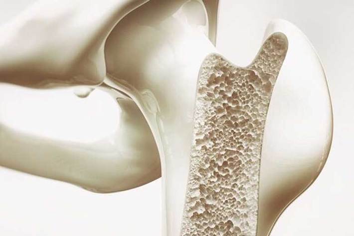 محققان دانشگاه «فریدریش شیلر ینا» با همکاری دانشگاه «ورستبورگ» آلمان دریافتند با افزودن فیبرهای کربن به سیمان کلسیم فسفات که برای تسریع بازسازی استخوان‌ها کاربرد دارد، می‌توان قابلیت خودترمیمی برای این سیمان، ایجاد کرد.