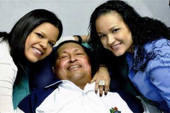 چاوز تحت شیمی درمانی با روحیه خوب