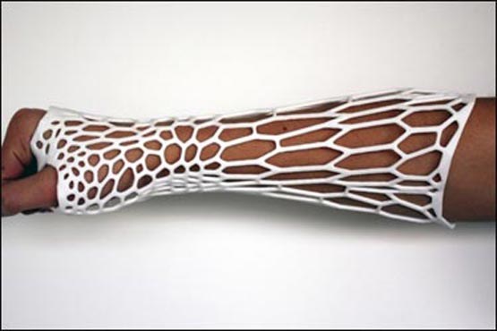 تولید غشا با چاپگر سه بعدی برای درمان شکستگی استخوان
