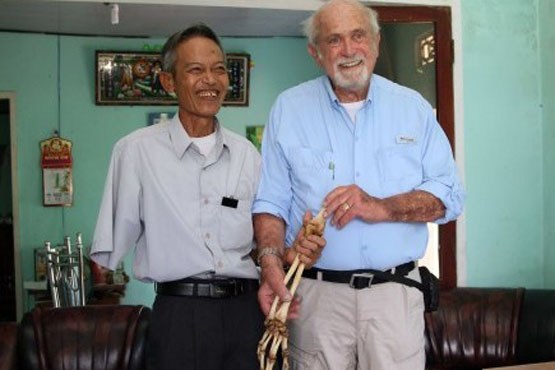 دریافت استخوان بازوی بریده  پس از 47 سال