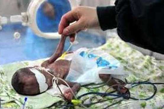 یکی از نوزادان 5 قلو فوت کرد