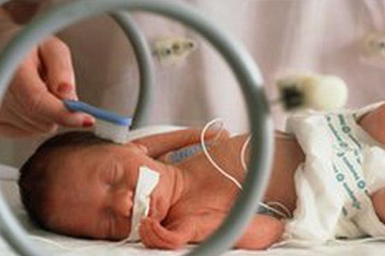 تولد نوزادی با 3 ریه در آبادان