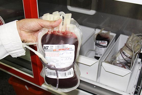 ایران جزو 5 کشور برتر دنیا در زمینه کیفیت انتقال خون