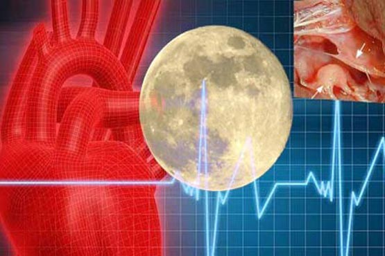 افزایش قدرت ترمیم بدن در جراحی قلب هنگام ماه کامل