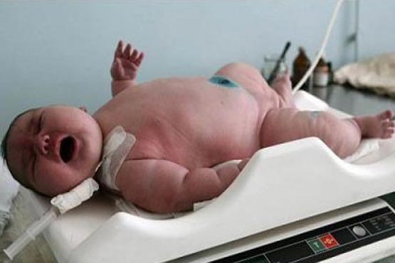 تولد نوزاد 6 کیلو و 200 گرمی در اسپانیا