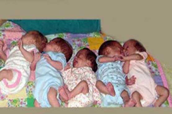 تولد نوزادان پنج قلو در مشهد