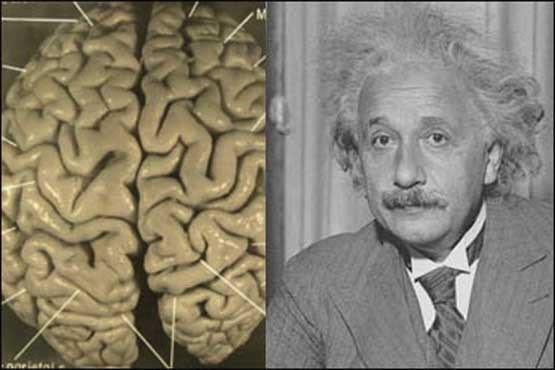 تفاوت مغز انیشتین با سایر انسان ها کشف شد