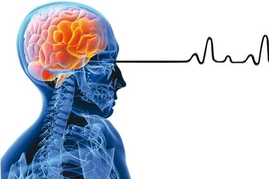 اولین علت سکته مغزی چیست؟/وضعیت فشار خون ایرانی ها
