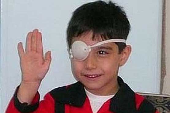 آغازطرح پیشگیری از «تنبلی چشم» کودکان زیر 7 سال