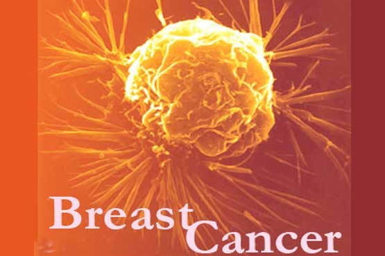ژنی که در درمان سرطان سینه موثر است