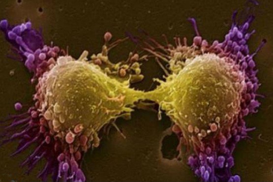 پروتئینی که می‌تواند کلید درمان سرطان باشد