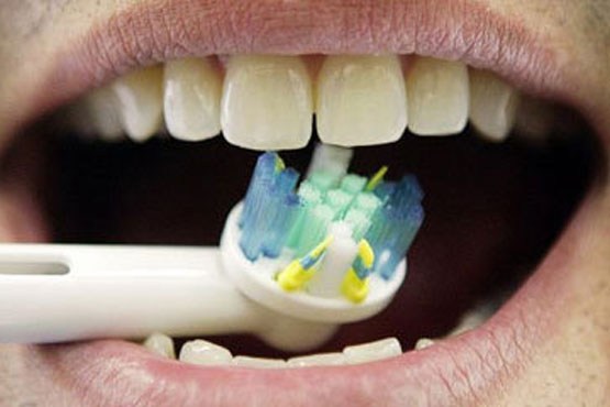 توصیه‌های جلوگیری از ایجاد حساسیت دندان