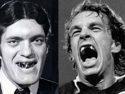 دندان زشت ترین فوتبالیست های دنیا! / تصاویر