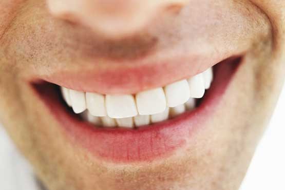 نوبرانه‌هایی که باعث سفیدی دندان می‌شود
