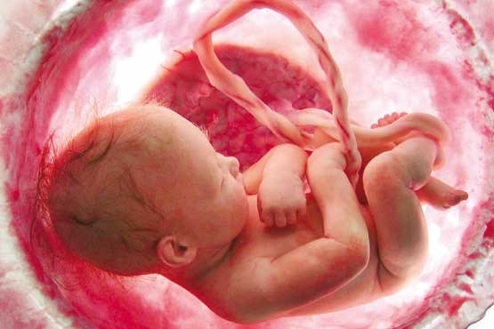 روی بدن کم باشد، جنین سقط می شود