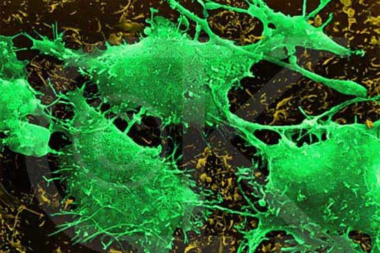 پروتئینی که مانع رشد تومورهای سرطانی می شود