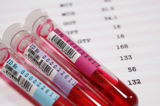 یک آزمایش خون برای تشخیص انواع سرطان