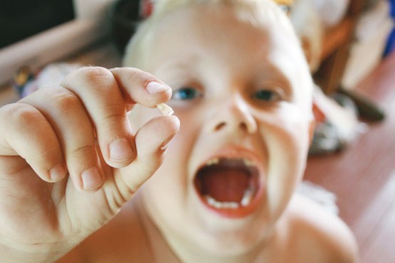 چگونه از دندان شیری بچه ها مراقبت کنیم ؟
