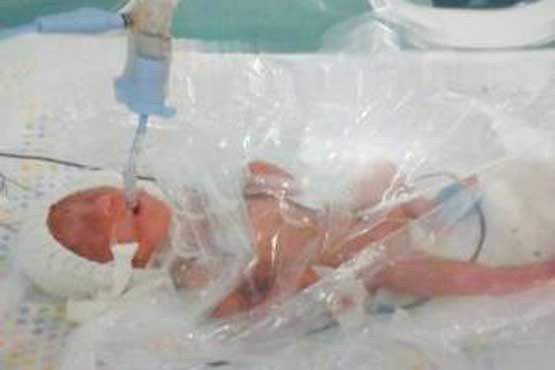 روش باور نکردنی پزشکان برای نجات یک نوزاد نارس