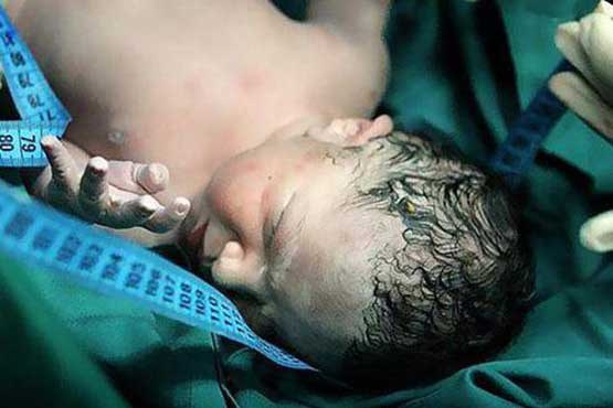 یک نوزاد بیرجندی در آمبولانس متولد شد