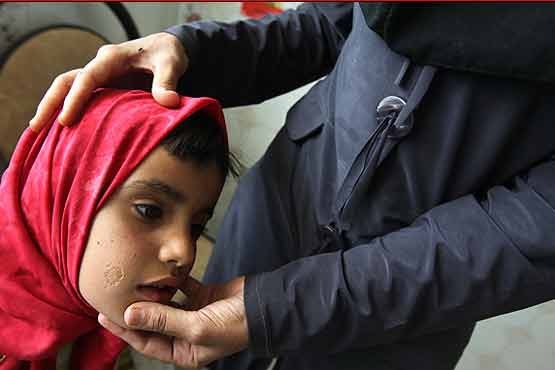 شیوع بیماری سالک در 17 استان ایران