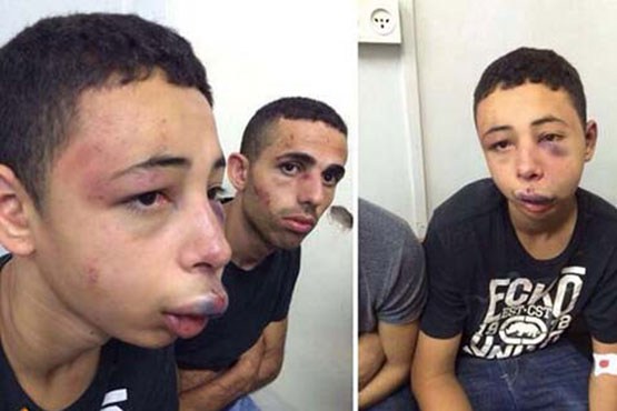 ضرب و شتم نوجوان فلسطینی از سوی صهیونیست ها