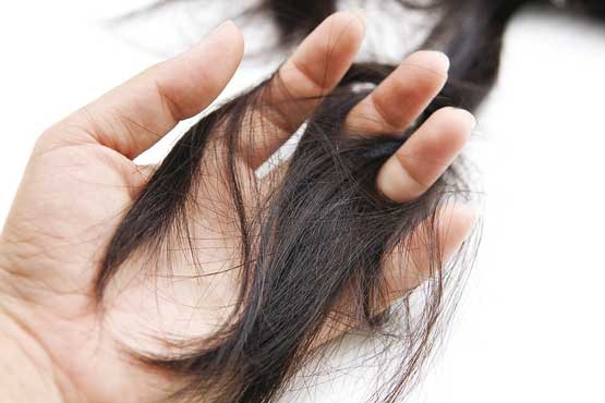 ۱۰ ماده خوراکی برای جلوگیری از ریزش مو