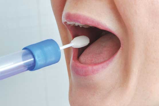 اندازه‌گیری میزان قند خون از روی بزاق دهان