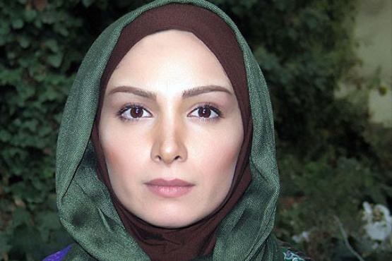 ضرر جراحی بینی برای بازیگر زن ایرانی