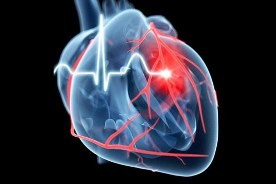 درد در کدام ناحیه بدن ، هشدار قلب است؟