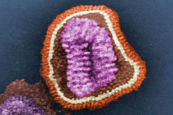 تلکام، ابولا را پیش بینی می‌کند