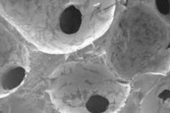 ساخت سلول های استخوان ساز از سلول های چربی