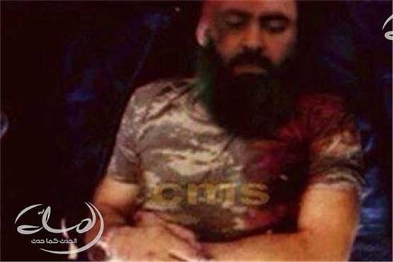 نخستین تصویر ابوبکر البغدادی پس از مجروح شدن