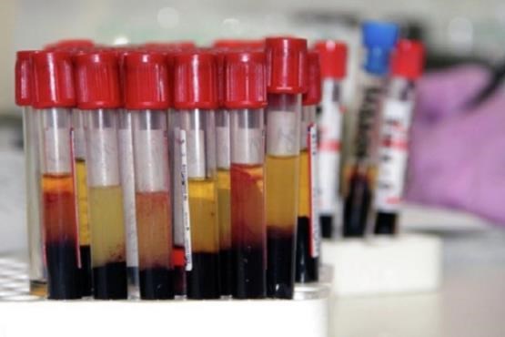 سرقت نمونه خون های آلوده به ابولا در گینه