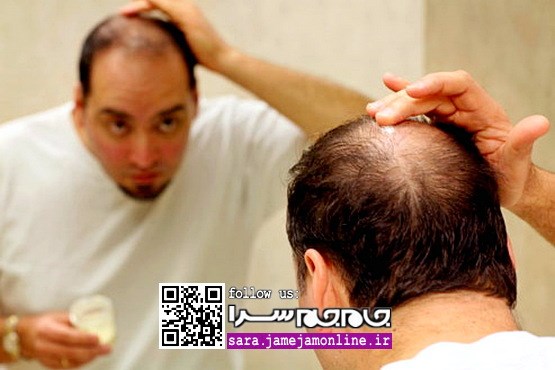 راهکار دارویی برای درمان ریزش مو در مردان