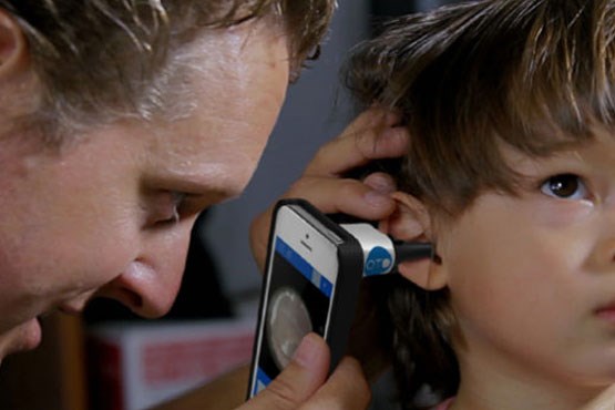 تشخیص عفونت گوش با دوربین تلفن هوشمند