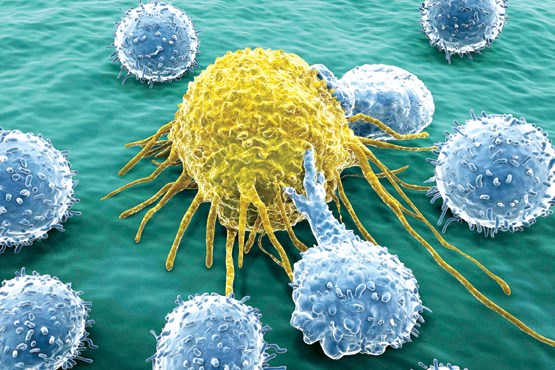 سرطان با میکروب حصبه درمان شد