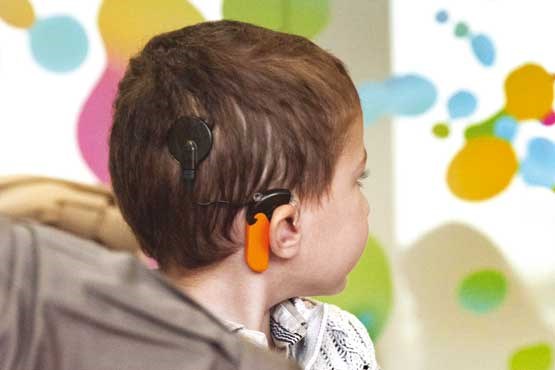 نقص شنوایی در کودکان