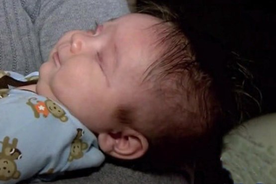 تولد نوزاد بدون چشم در امریکا + عکس