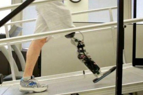 ساق پای هوشمند در ایران ساخته شد