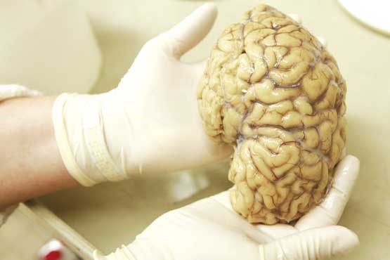 سلول‌های جدید مغز شناسایی شدند