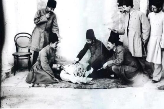 کشیدن دندان با گازانبر در دوره قاجار/ عکس