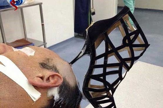 پاشنه کفش زن در سر شوهر! + عکس