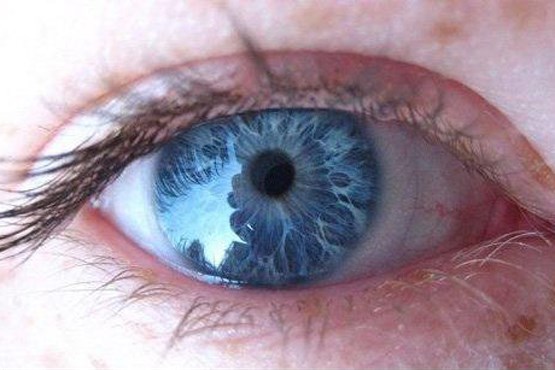 چشم آبی حاصل جهش ژنتیکی است +عکس